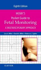 MOSBY'S POCKET GUIDE TO FETAL MONITORING  Paperback