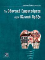 Τα οδοντικά εμφυτεύματα στην κλινική πράξη