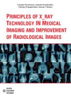 Principles of X_ray technology in medical imaging and improvement of radiological images